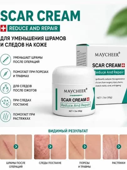 Maycheer крем от рубцов , шрамов , растяжек , пятен после угрей, акне — SAFICAS-КРЕМ